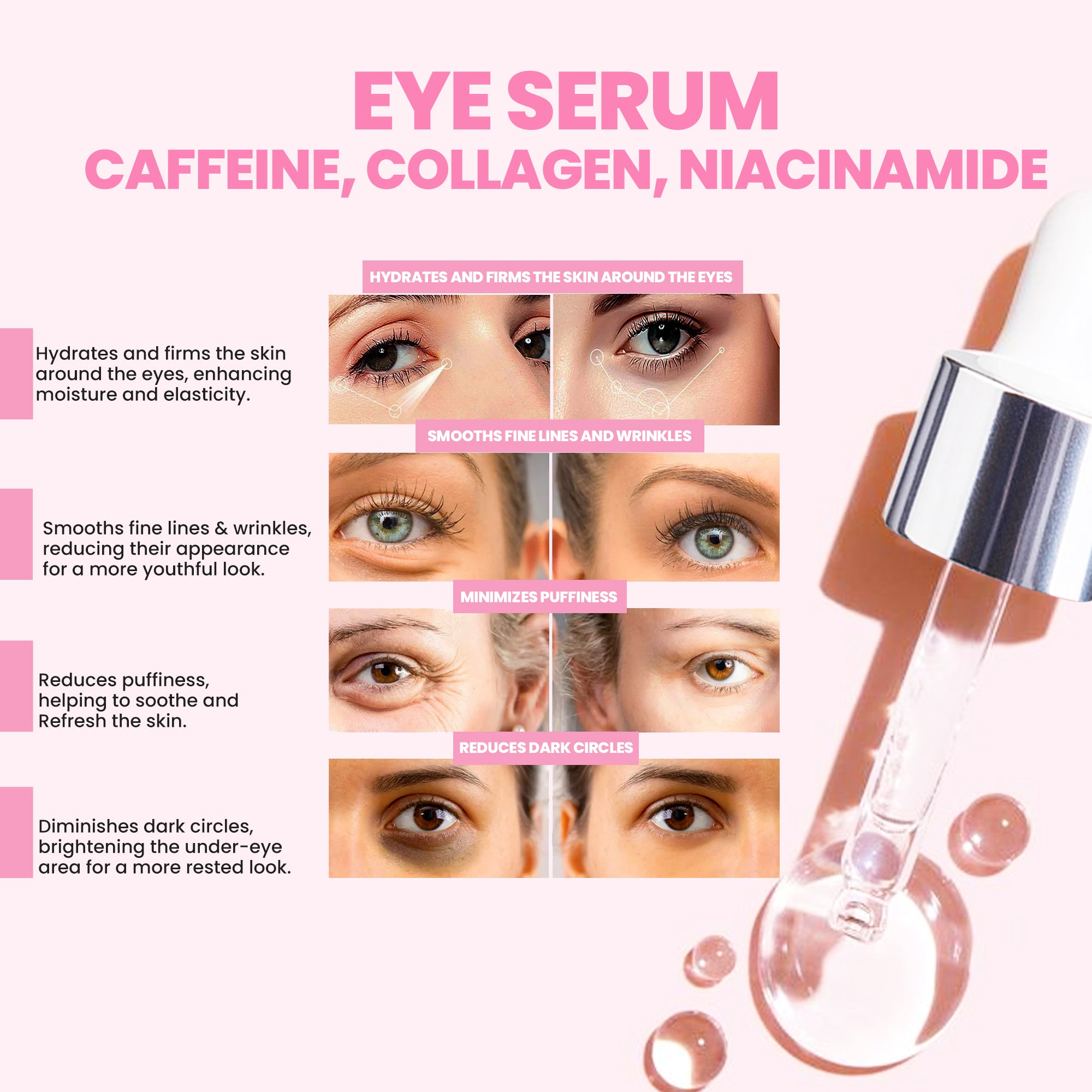 Anti-Aging Eye Serum for Dark Circles, Puffiness & Wrinkles - Hyaluronic Acid & Retinol Formula 1.7Oz