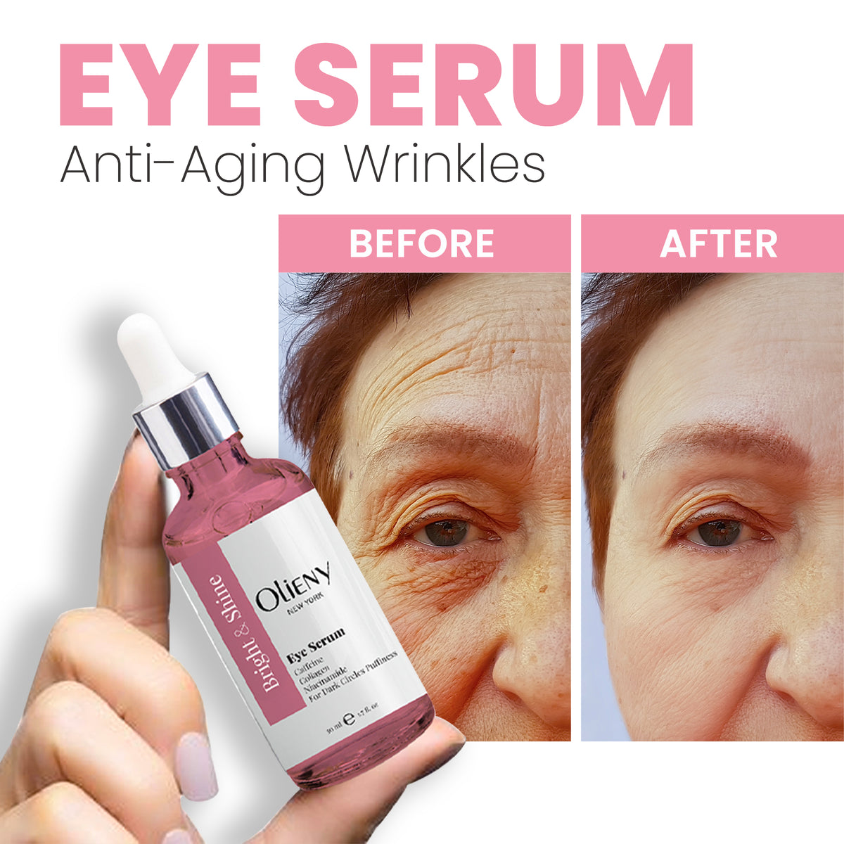 Anti-Aging Eye Serum for Dark Circles, Puffiness & Wrinkles - Hyaluronic Acid & Retinol Formula 1.7Oz