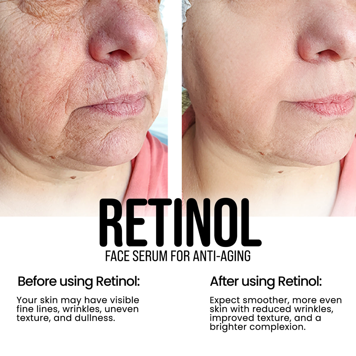 Retinol Face Serum for Anti-Aging & Acne - Reduce Wrinkles & Fine Lines 1.7Oz